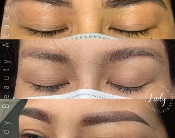 Xử Lý Chân Mày Trổ Xanh Trổ Đỏ Trổ Tím - Lady Beauty Academy
